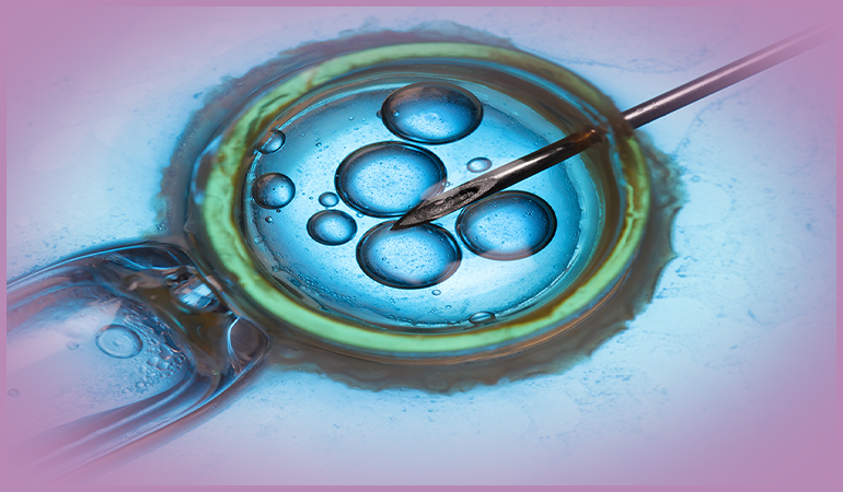 IVF